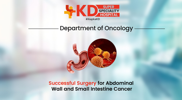 Abdominal Cancer