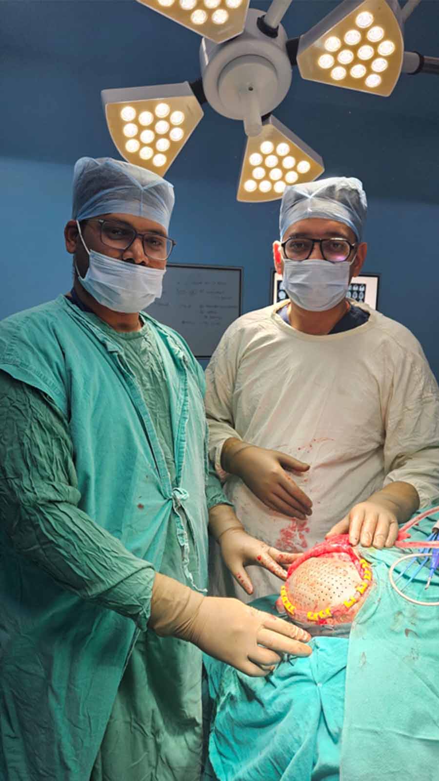 skull bone treatment