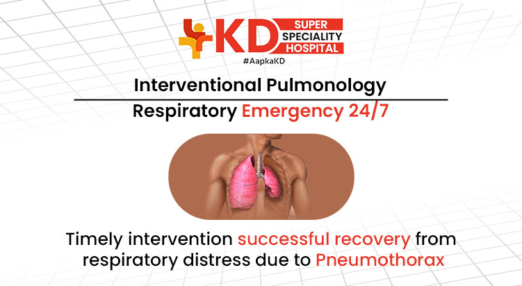 Pneumothorax